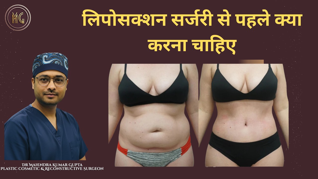 before liposuction surgery | Dr Mahendra kumar gupta | plastic surgeon in indore