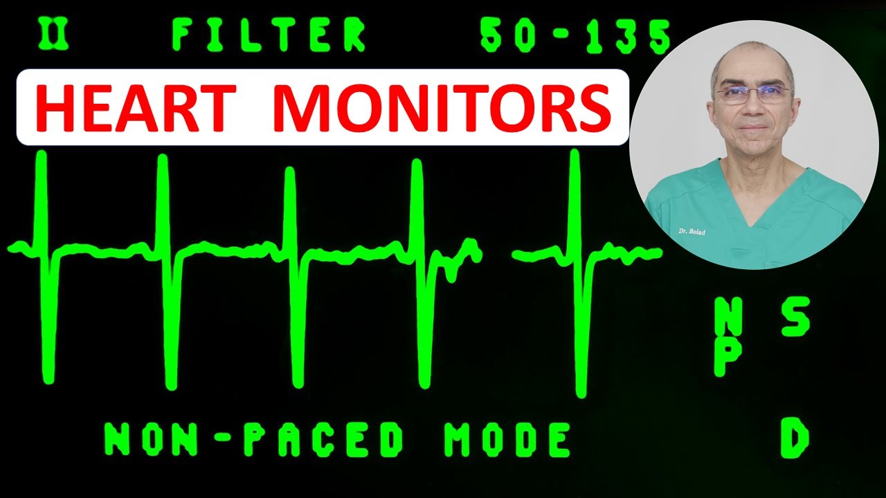 Heart Monitors