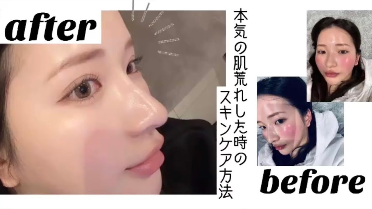 【スキンケア】NO案件❌肌荒れ最新スキンケア🫧レスキューアイテム🧖🏻‍♀️🥚赤み/乾燥/酒さ