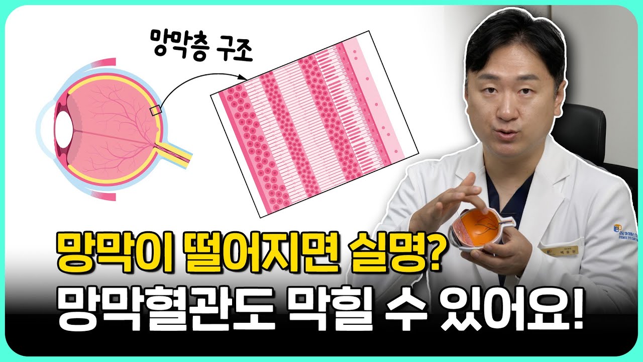 망막이 떨어지면 정말 실명하나요? 망막혈관이 막히면 어떻게 되나요?