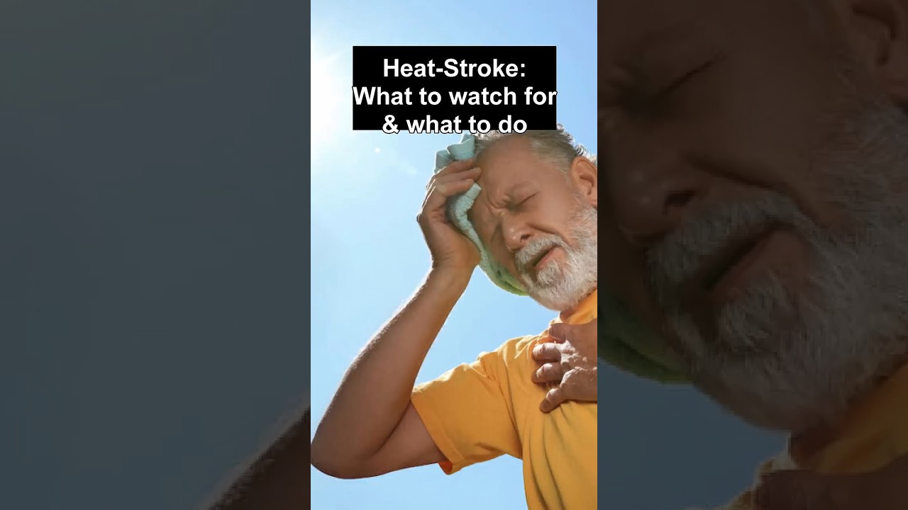 Heat stroke: not the summer glow-up you want 🥵 #MedicalEducation  #medicine #hospital