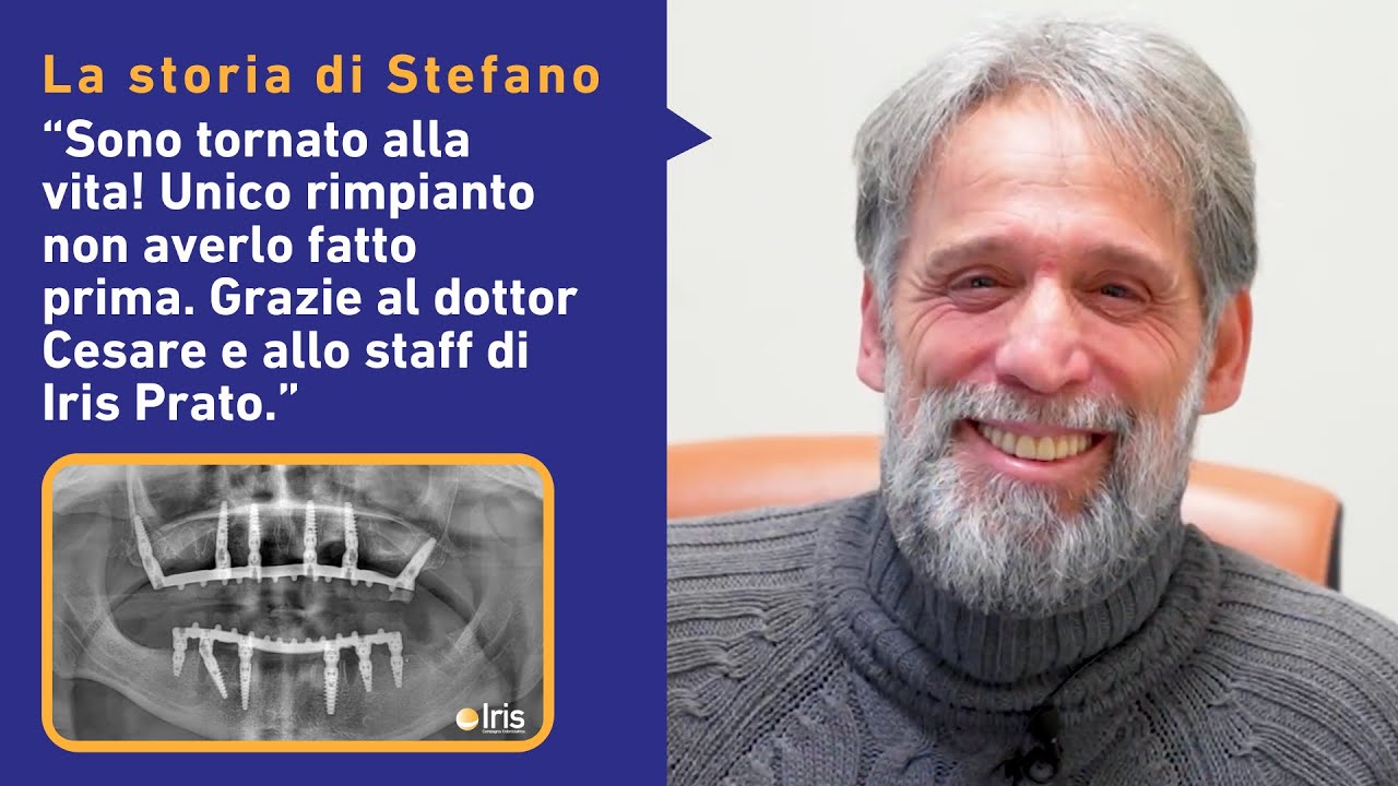 Addio ai Problemi ai Denti: Stefano Ritrova il Sorriso Fisso in 24 Ore