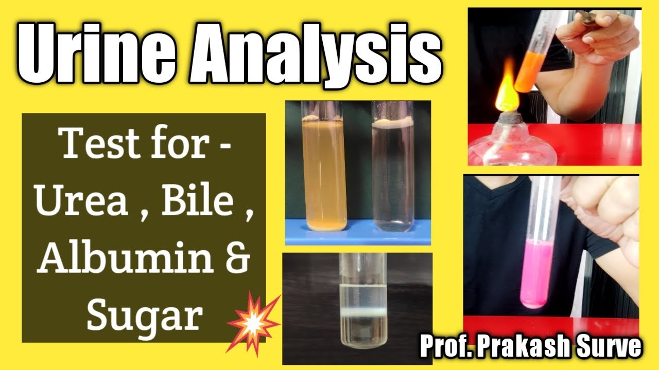 Urine Analysis for Normal and Abnormal constituents -  ( Test for - Urea , Bile , Albumin & Sugar )