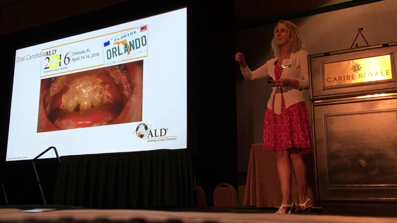 Annette Quinn - Oral Mucositis Academy of Laser Dentistry 2016