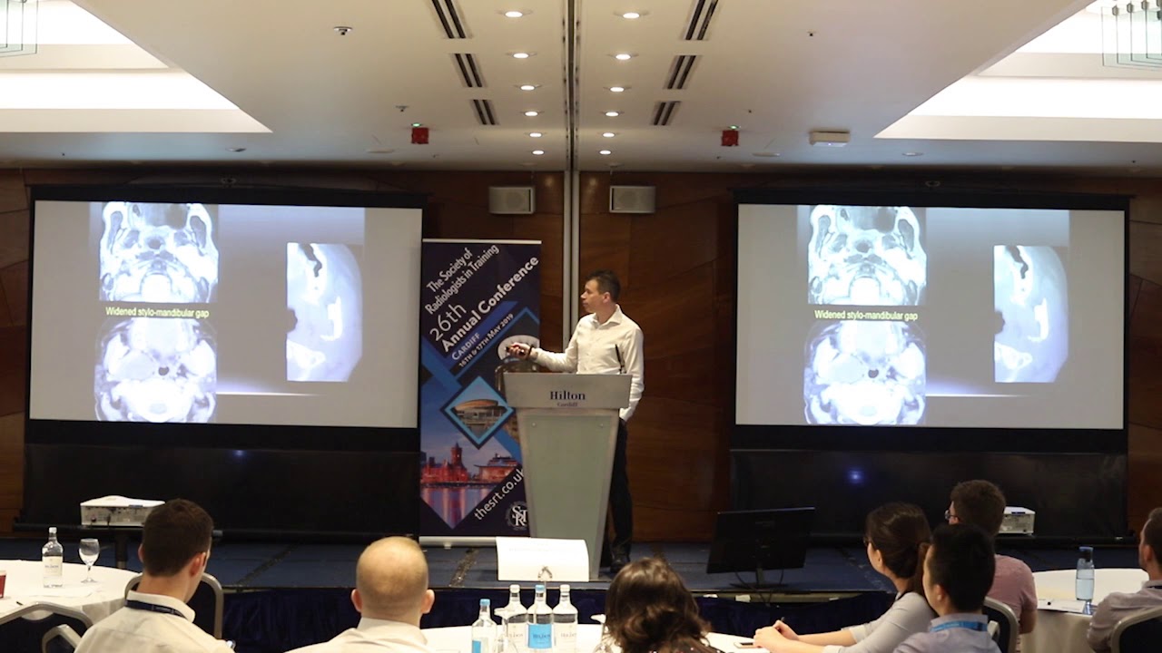 Radiology Rewind: SRT 2019 - 'Pearls and Pitfalls in Head and Neck Imaging' by Dr Steve Connor