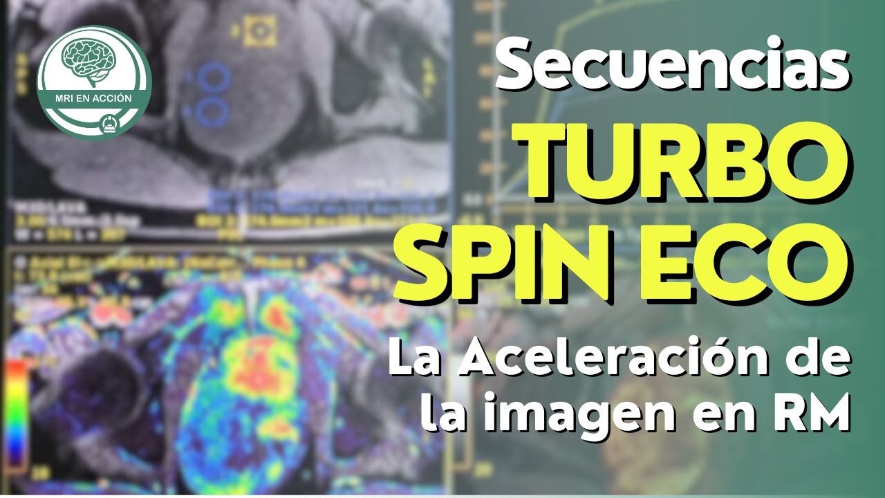 Secuencias Turbo (Fast) Spin Eco - La Aceleración de la imagen en RM (2/2)