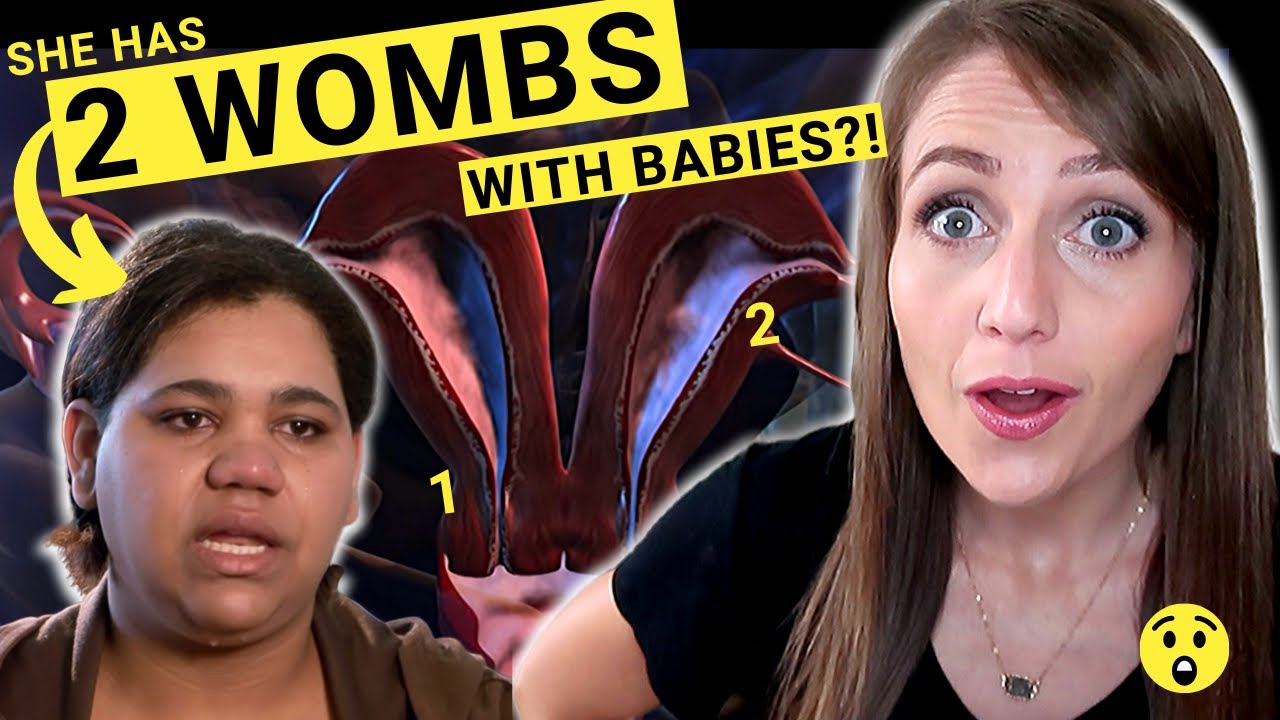 ObGyn Reacts: Pregnancy in BOTH Uteruses!? (Strange Pregnancy Didelphys)