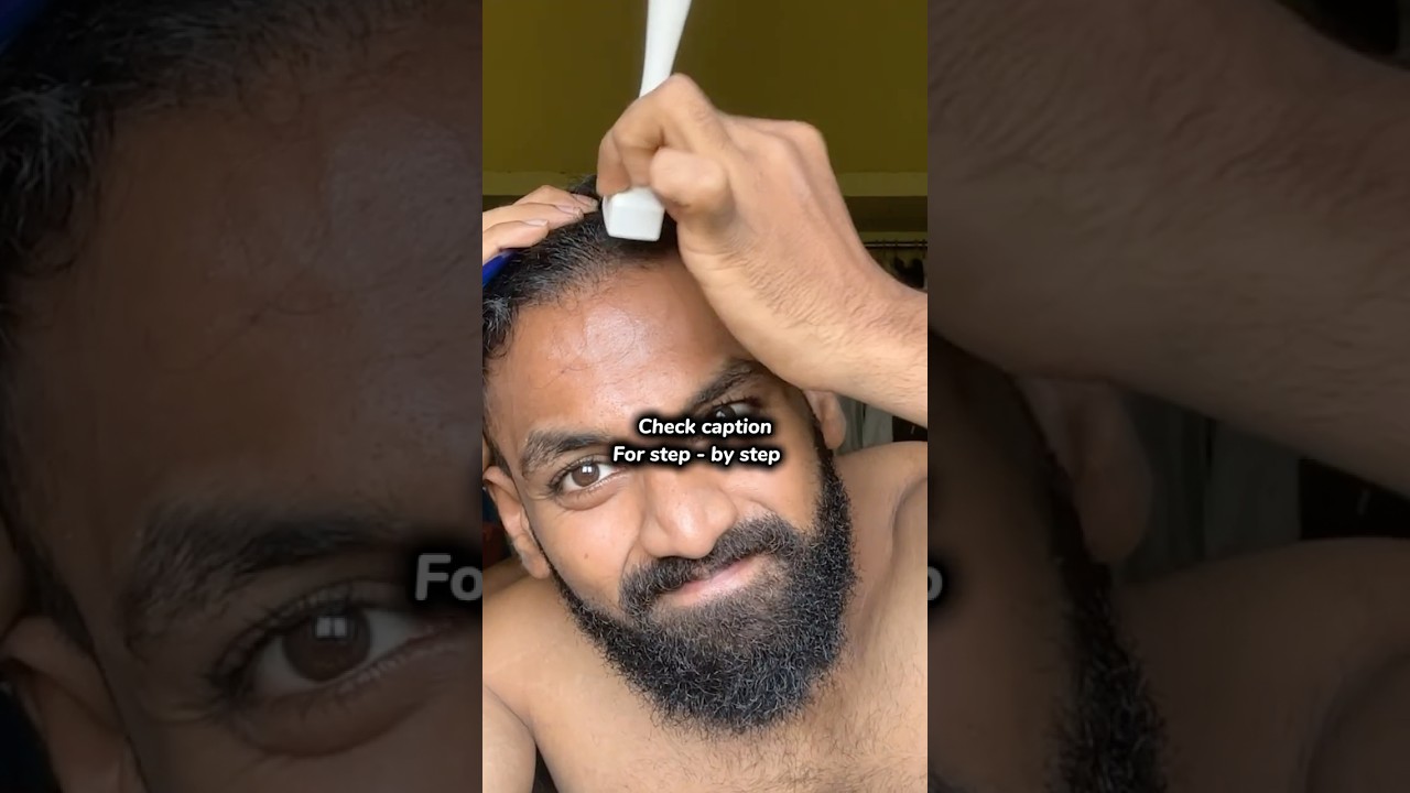 Derma rolling methods #hair #hairlosstreatment #dermaroller #dermarolling
