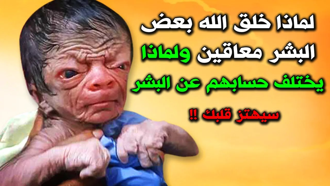 لماذا خلق الله بعض البشر معاقين ؟ولماذا يختلف حسابهم عن البشر؟وماذا يحدث لهم يوم القيامة ؟سيهتز قلبك