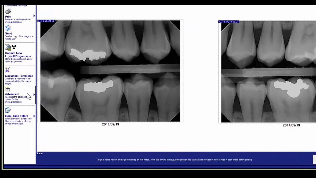How to Move X-rays to a Different Patient | DentiMax Dental Imaging Tip