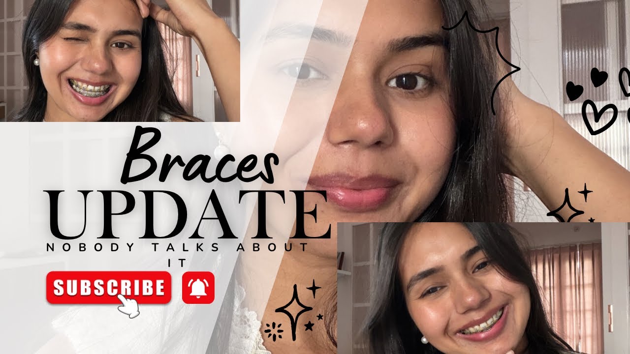 10 Months of Braces: Physical Pain vs. Mental Gains