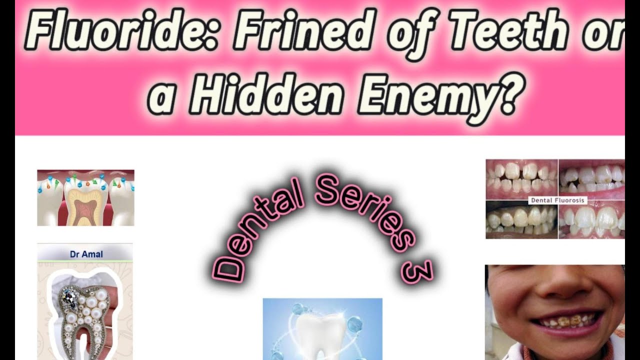 السر الخفي وراء الفلوريد…Fluoride Hidden Secret