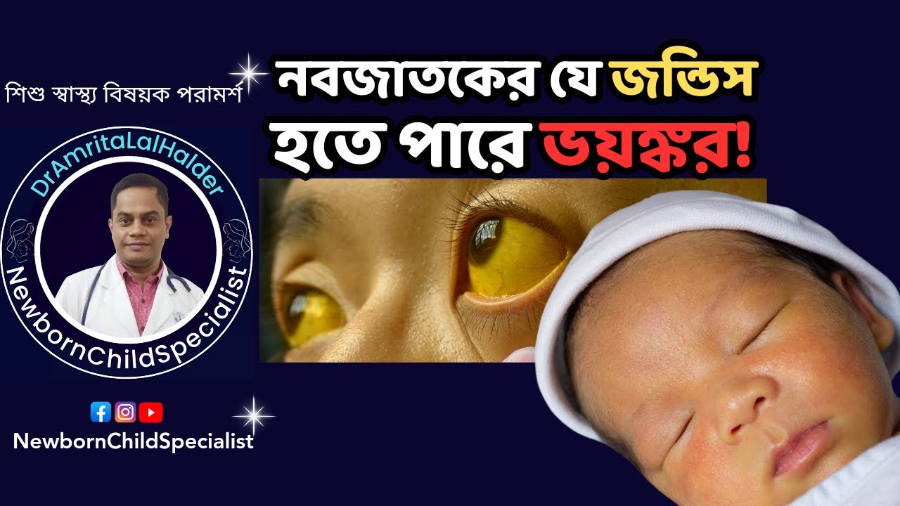 নবজাতকের জন্ডিস! এই ৫ টি লক্ষন বিপদজনক! Neonatal jaundice in bangla.