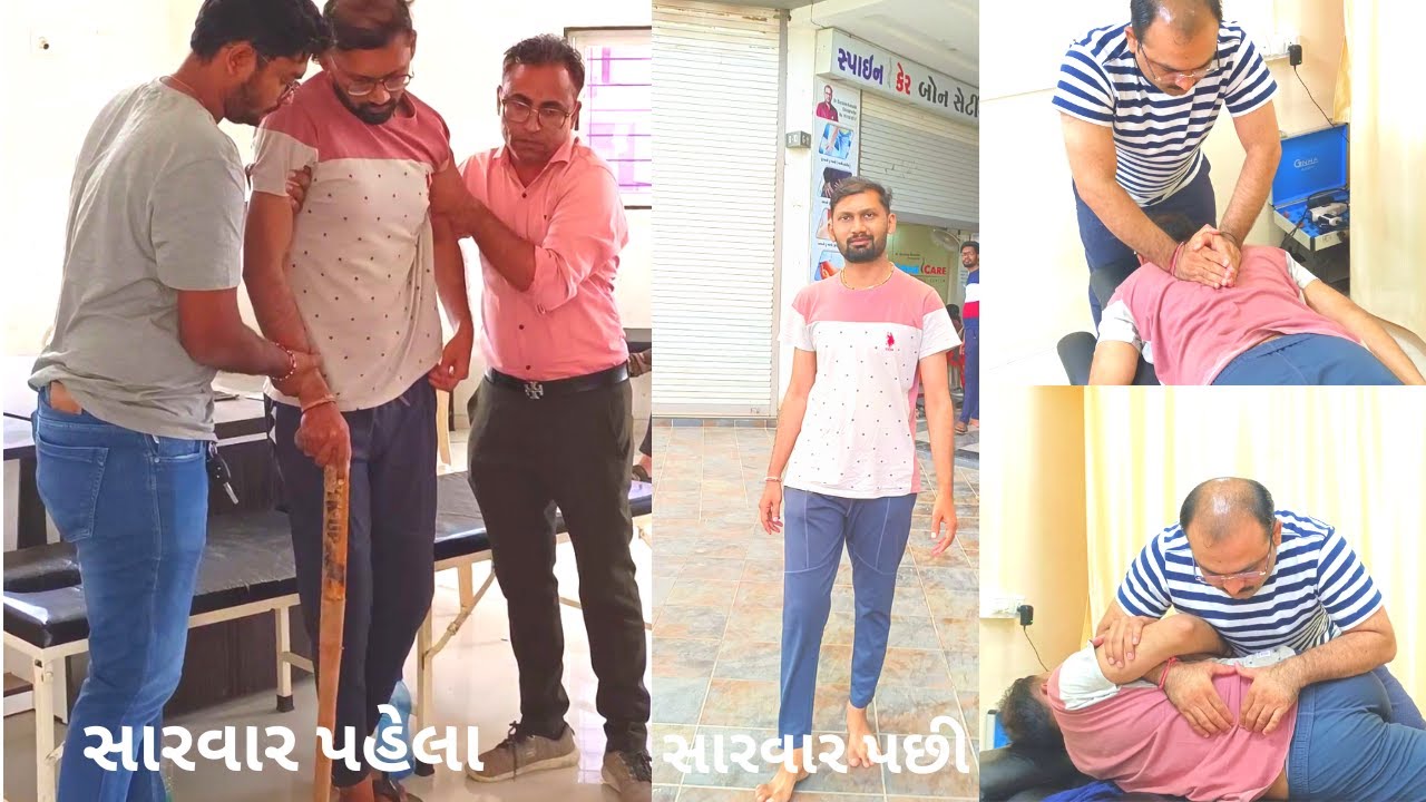 ઑપરેશન વગર ખસી ગયેલી કમરની ગાદીનો એક માત્ર સરળ ઈલાજ by #chiropractic_treatment Dr #darshan_kamothi