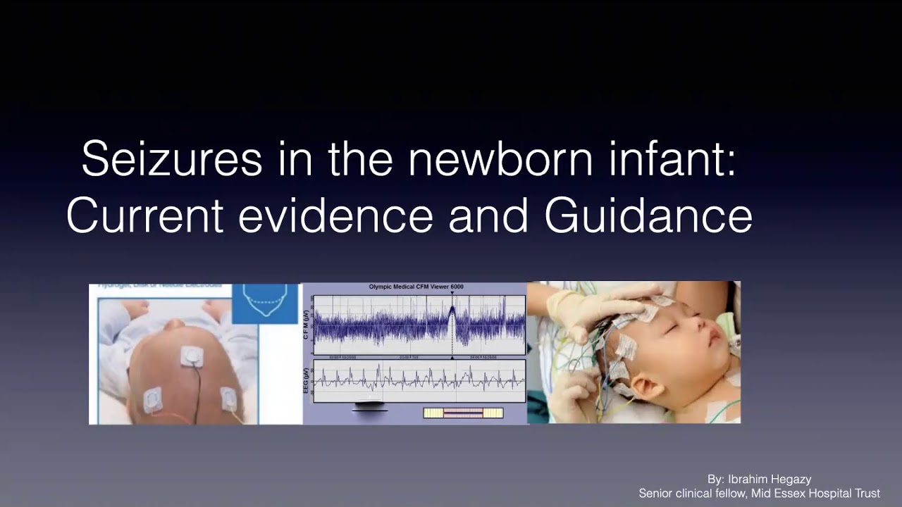 Neonatal seizure
