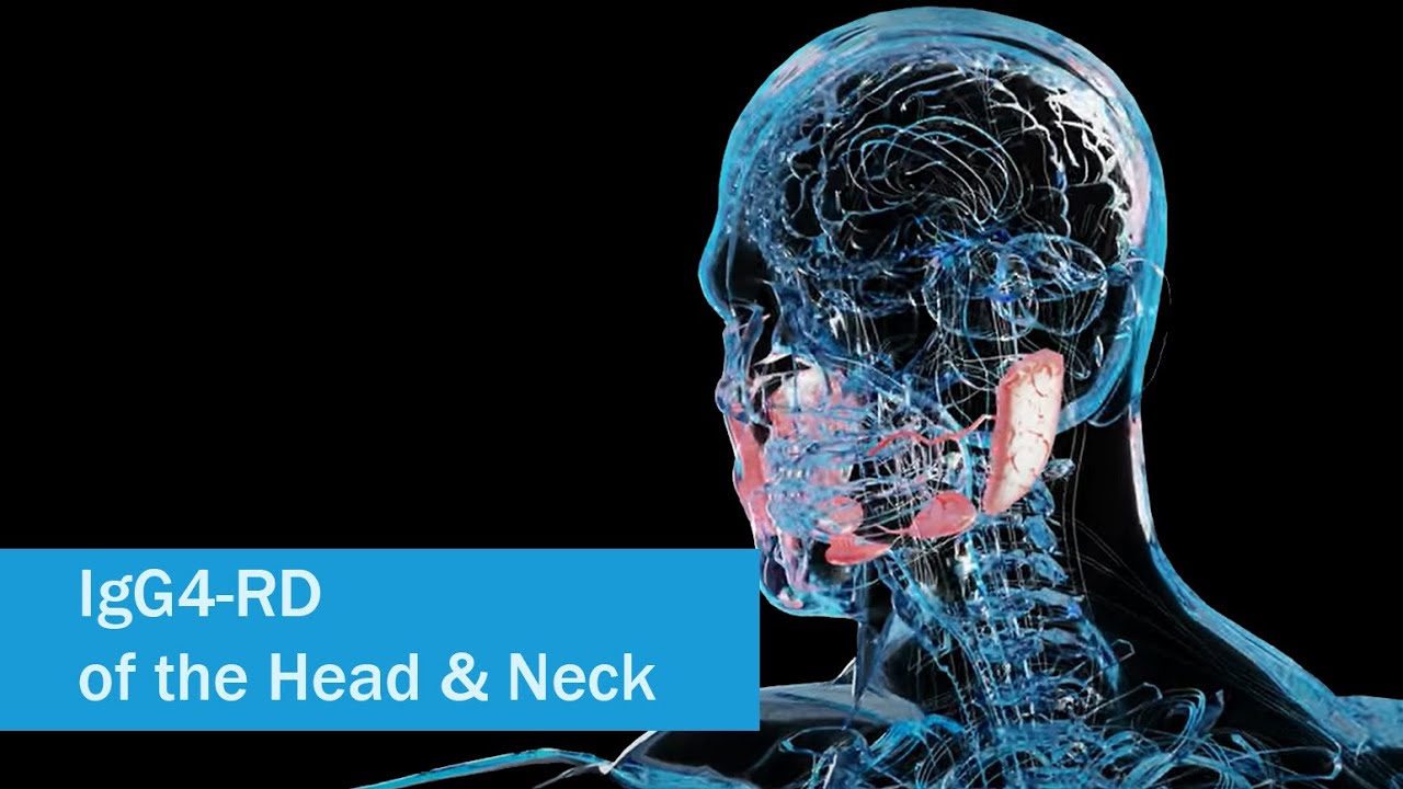 IgG4-RD and You: IgG4-RD of the Head and Neck