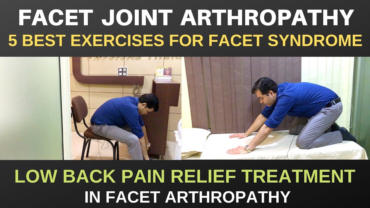 Facet Joint Arthropathy, L4-L5,L5-S1 Facet Joint Pain Relief Exercises, Facet Arthropathy Treatment
