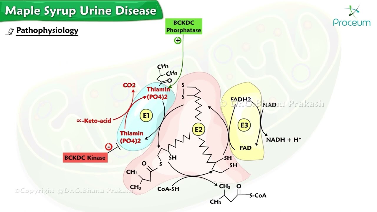 Maple Syrup Urine Disease : Pathophysiology, Clinical features, Diagnosis , Treatment : USMLE Step 1