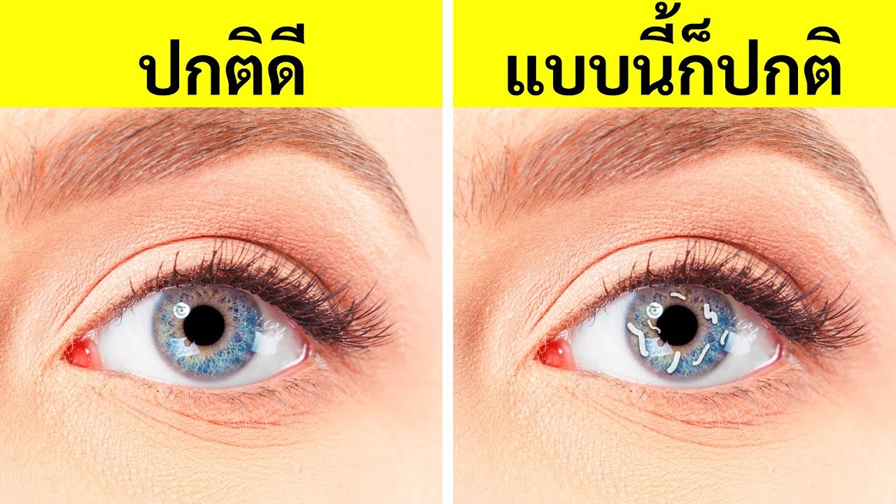 ปฏิกิริยาแปลกๆ 11 แบบของร่างกายที่คุณพบเจอได้ในชีวิตประจำวัน