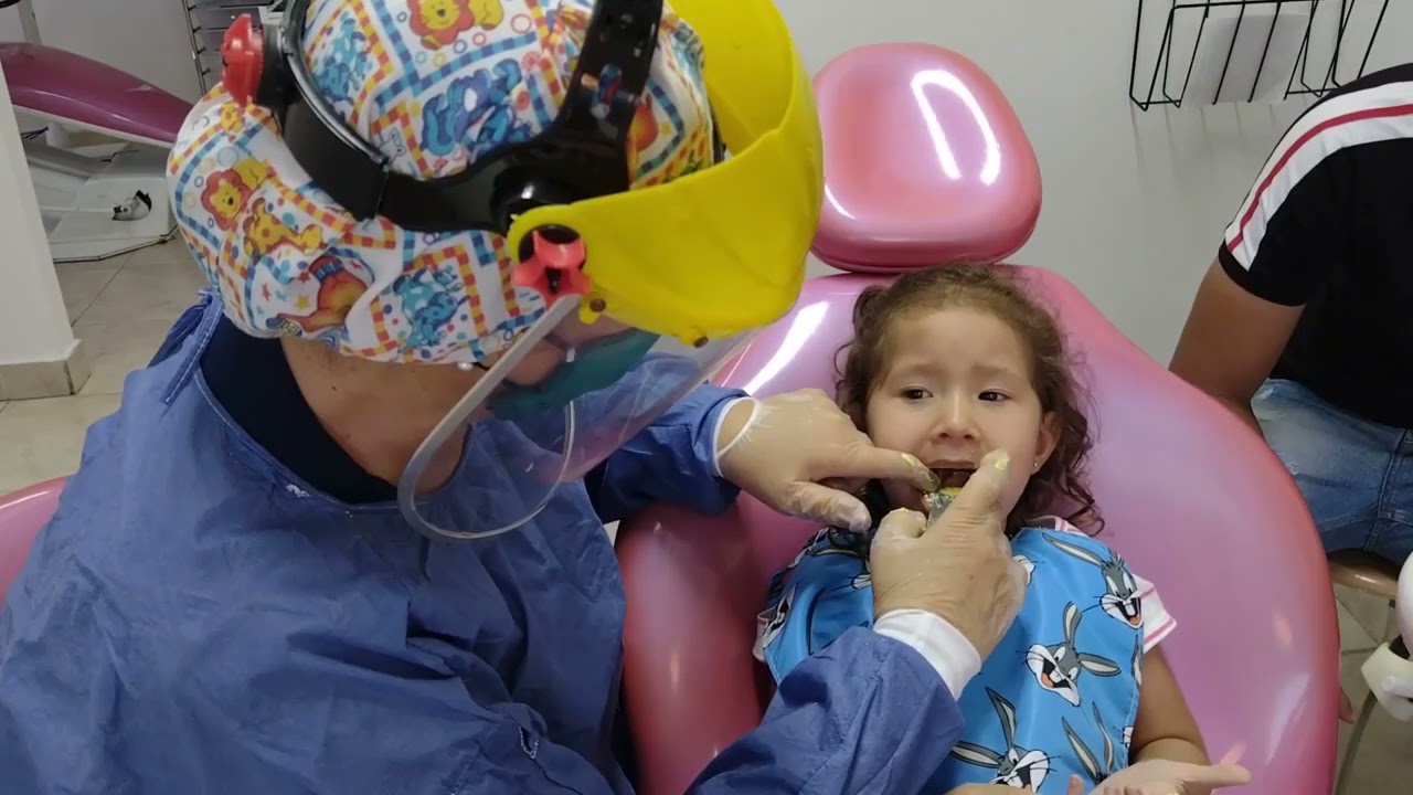 Odontólogo para niños  en Barranquilla Mordida cruzada anterior en niños - Smile Center