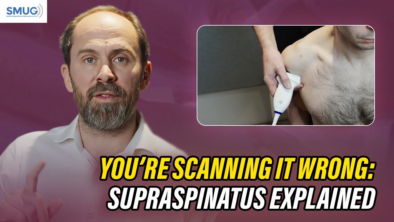 Do not miss a supraspinatus tear ! How to scan supraspinatus perfectly!