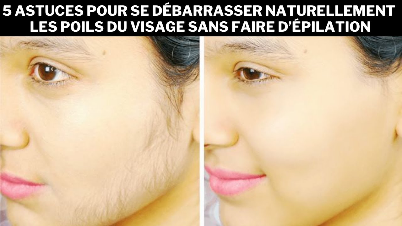 5 astuces pour se débarrasser naturellement les poils du visage sans faire d’épilation