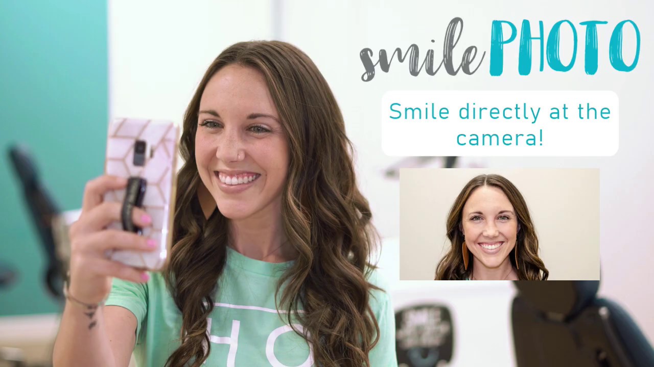 How to Take Smile Photos For A Virtual Consult