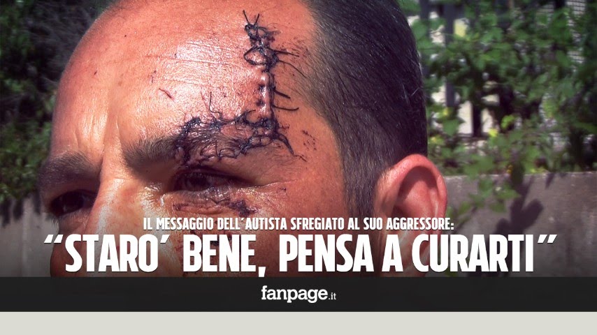 Autista ANM sfigurato: 