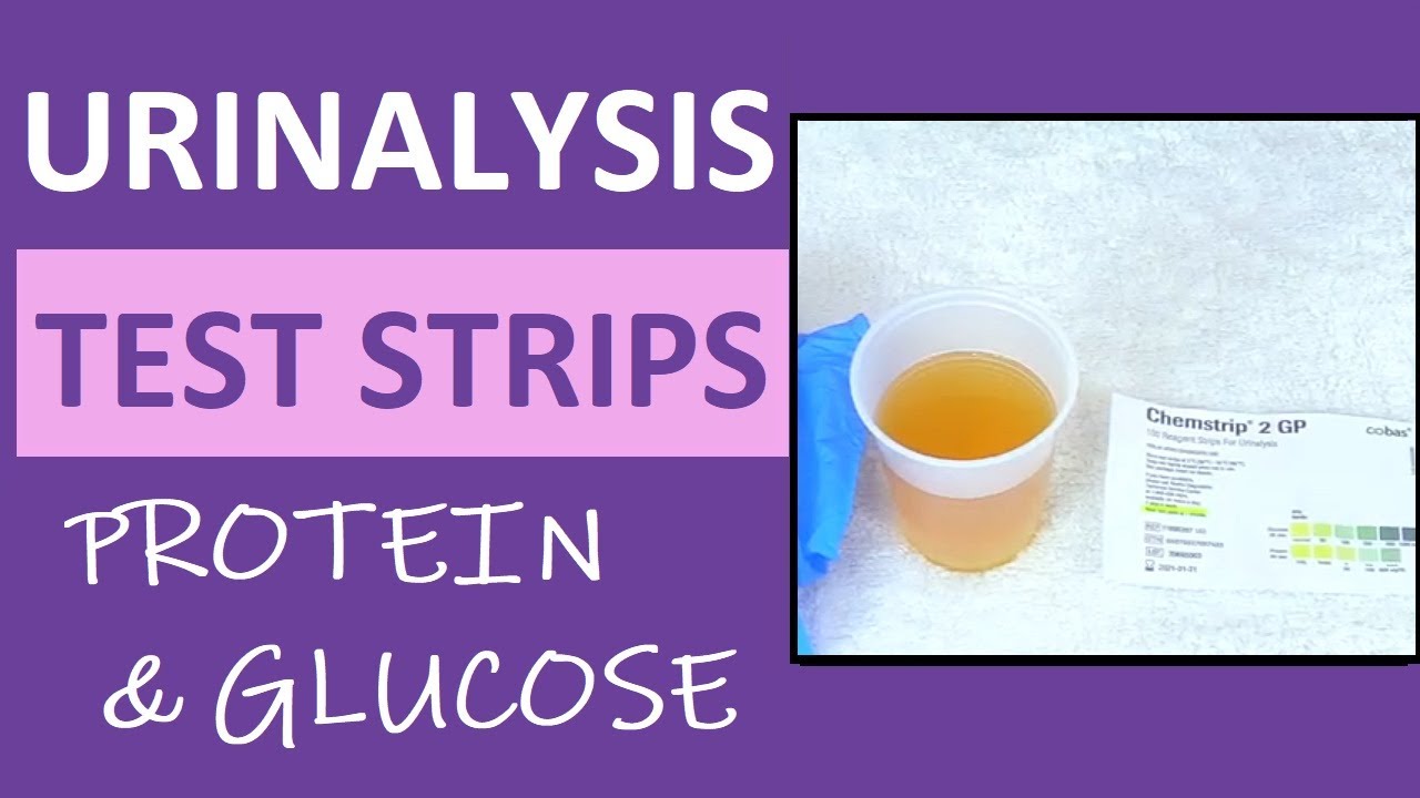 Pregnancy Urinalysis: Protein & Glucose in Urine Reagent Test Strips