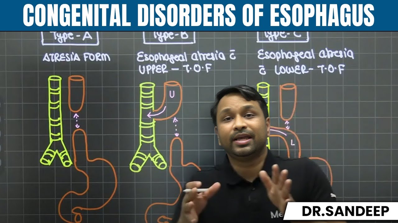Congenital Disorders of Esophagus | Surgery | Bailey learned with Dr. Sandeep | PW MedEd