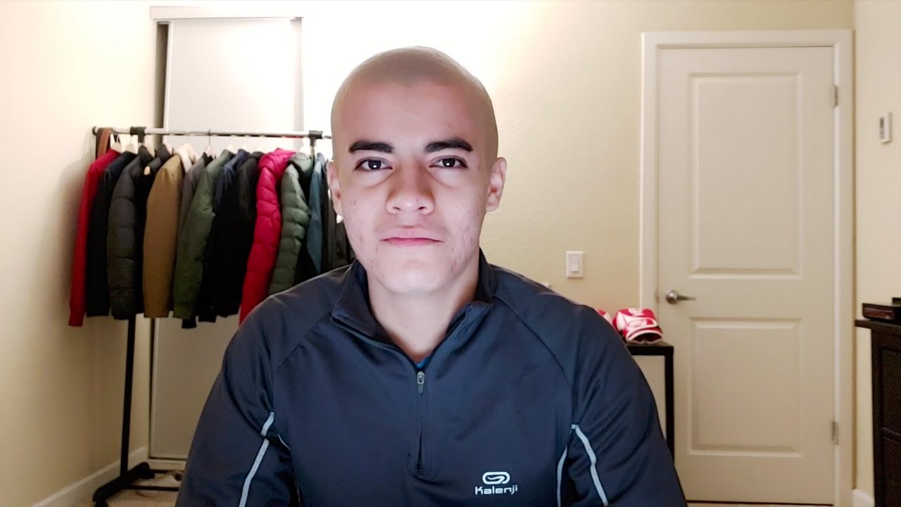 Being Bald At 18, A Rant
