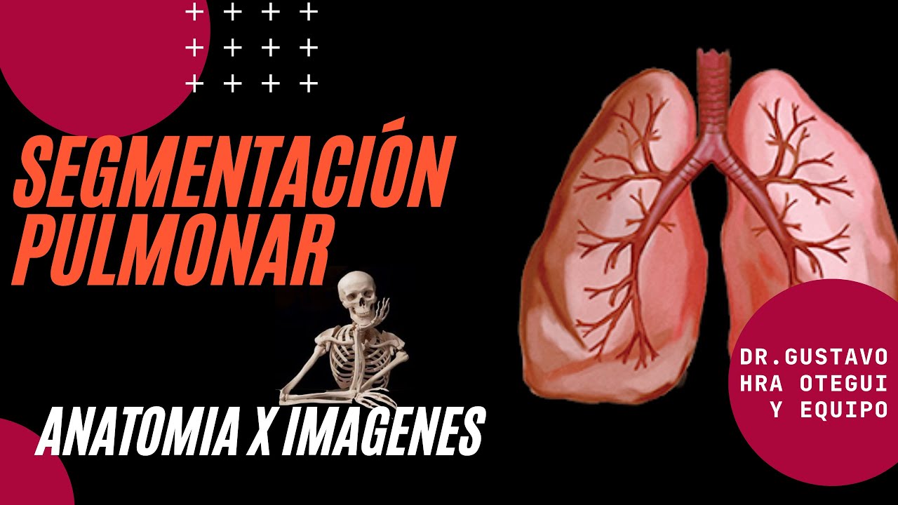 Segmentación pulmonar en Tomografia