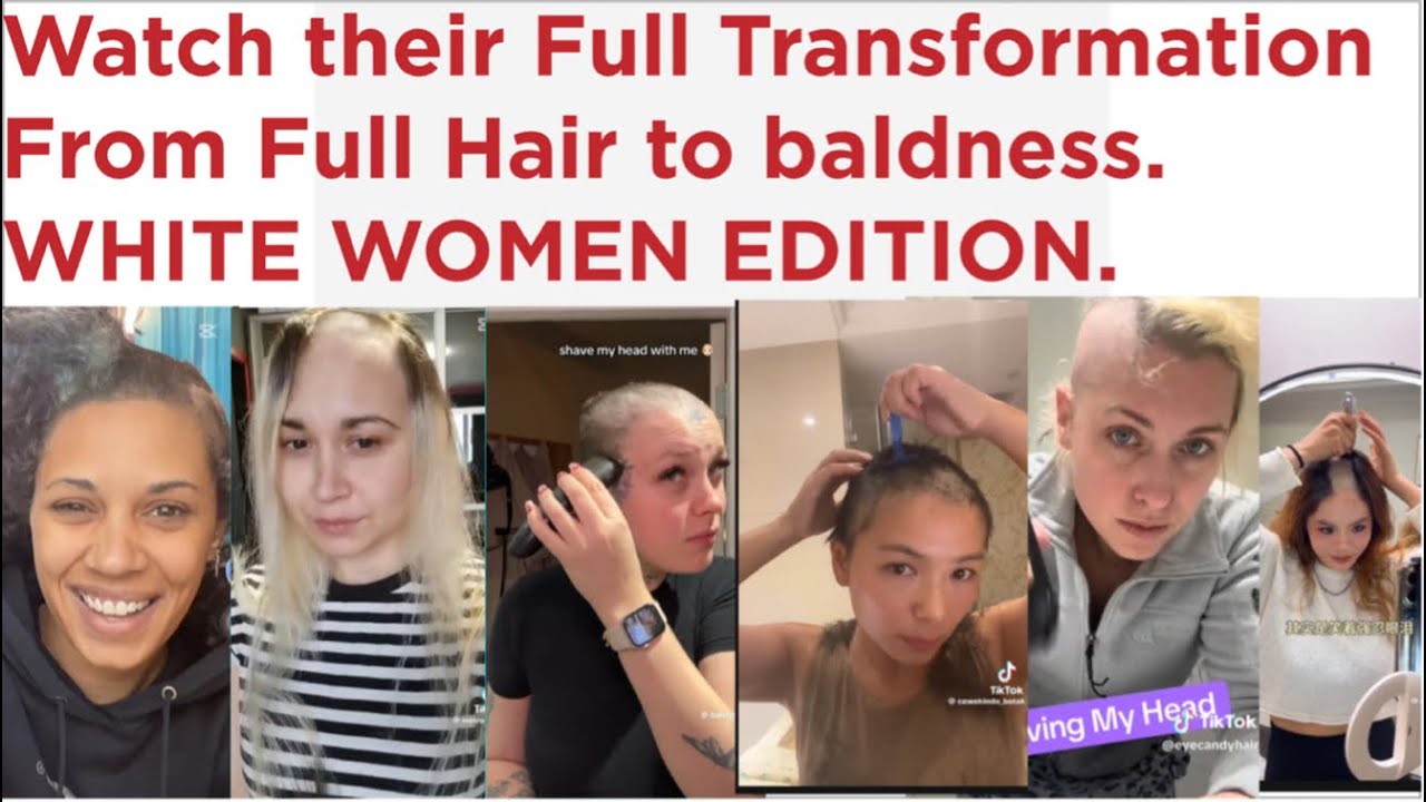 These WhiteWomen went Bald because it radiates Confidence||they decided totake control of their look