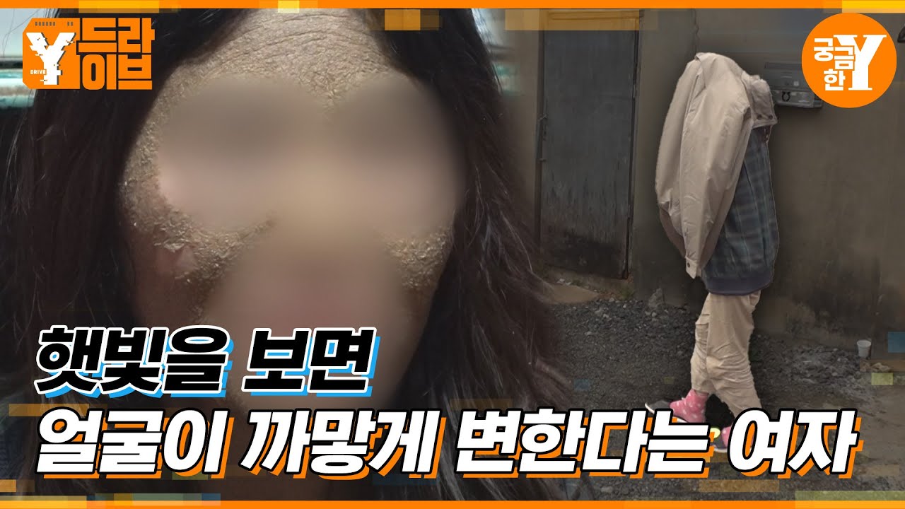 «Мне больно, когда я смотрю на свет». Женщина, запертая в темноте на 10 месяцев