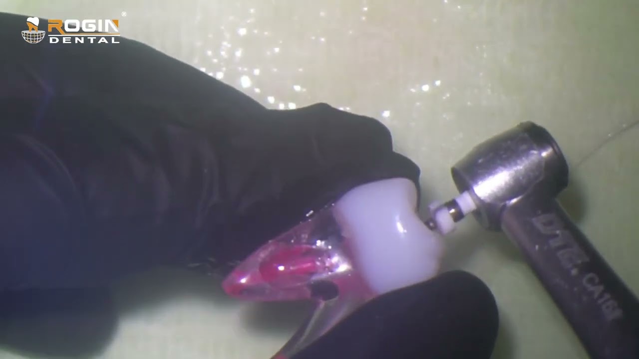 Watch Dr. @glynisendo in action with Rogin’s 𝐑-𝐒𝐇𝐀𝐏𝐄𝐑 and 𝐑𝐨𝐨𝐭 𝐂𝐚𝐧𝐚𝐥 𝐈𝐫𝐫𝐢𝐠𝐚𝐭𝐢𝐨𝐧 𝐍𝐞𝐞𝐝𝐥𝐞𝐬!