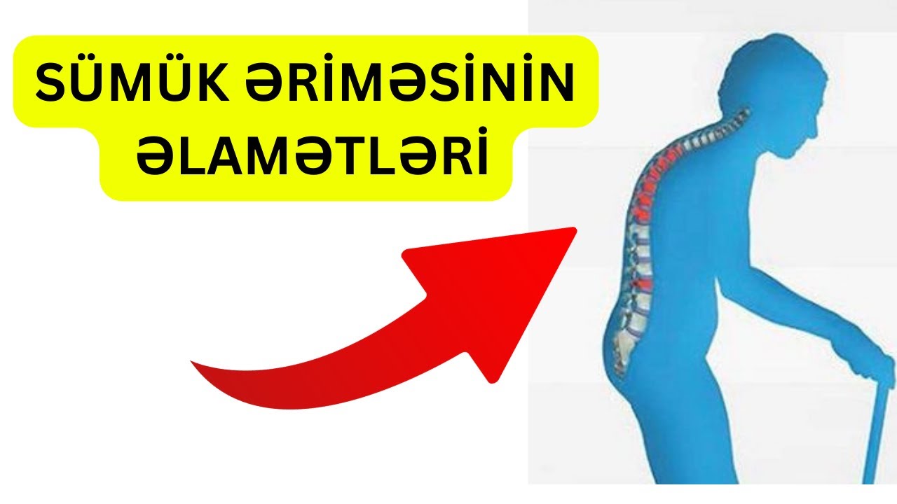 Sümük əriməsinin ƏLAMƏTLƏRİ - İZLƏYİN