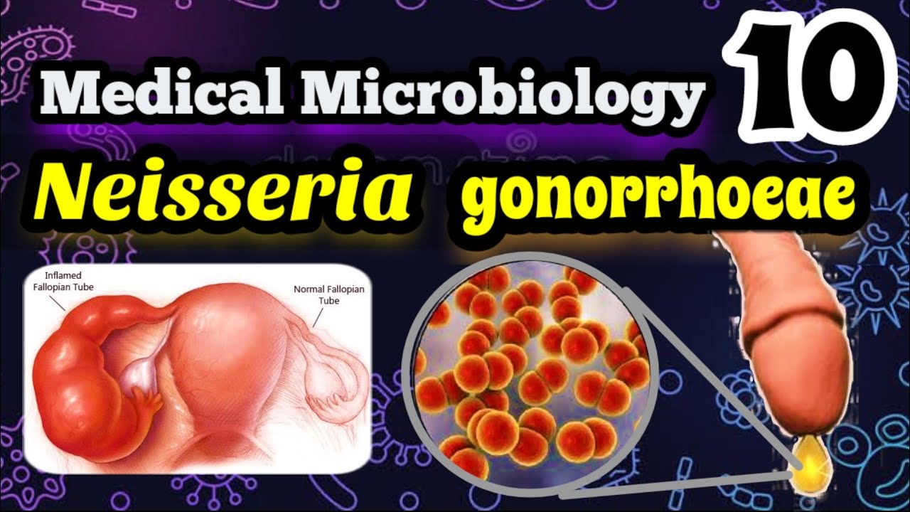 Neisseria gonorrhoeae شرح بالعربي البكتيريا المسببه لمرض  السيلان وطرق علاجه