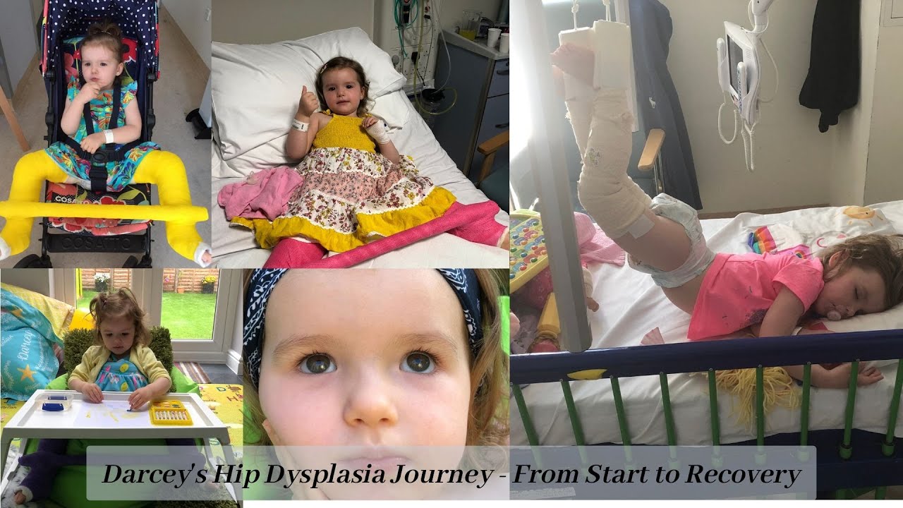 Hip dysplasia Journey, from start to recovery, 4 surgeries, 3 casts, 1 brave girl