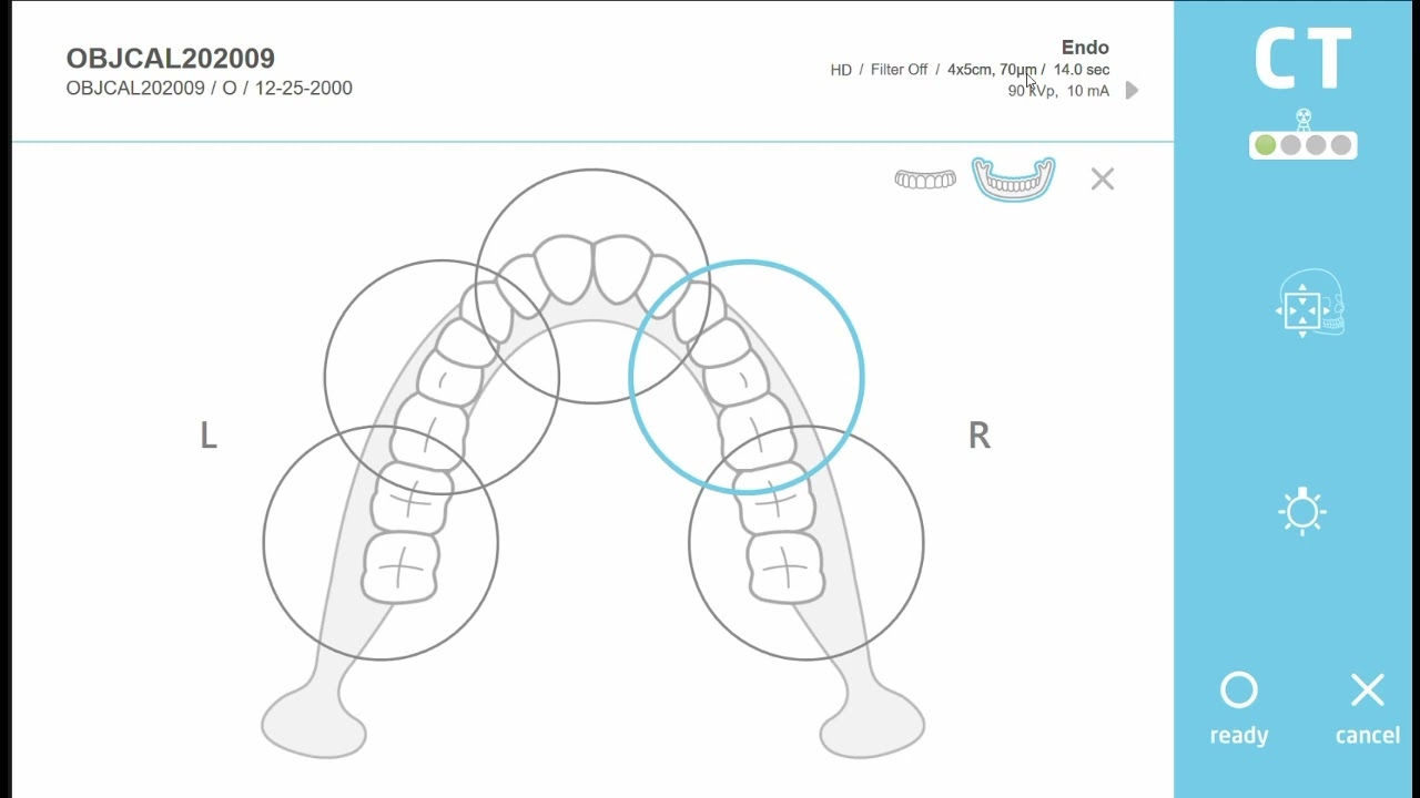CBCT Field of Views (FOV)