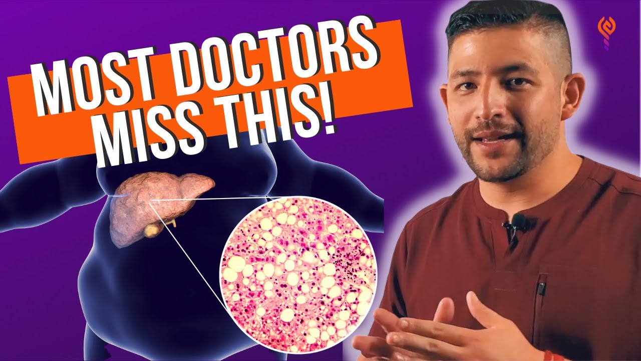 How A Fatty Liver is Diagnosed | Understanding Your NAFLD Results