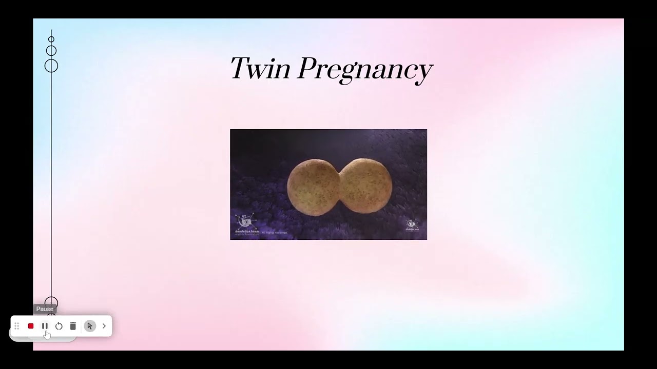 Multiple Gestation for NUR 317 and 514