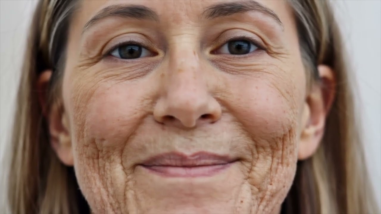 Lines On My Face
