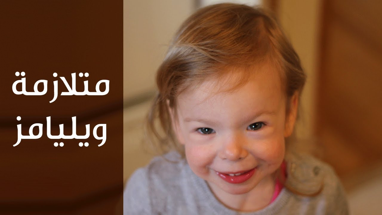متلازمة ويليامز ( Williams syndrome )
