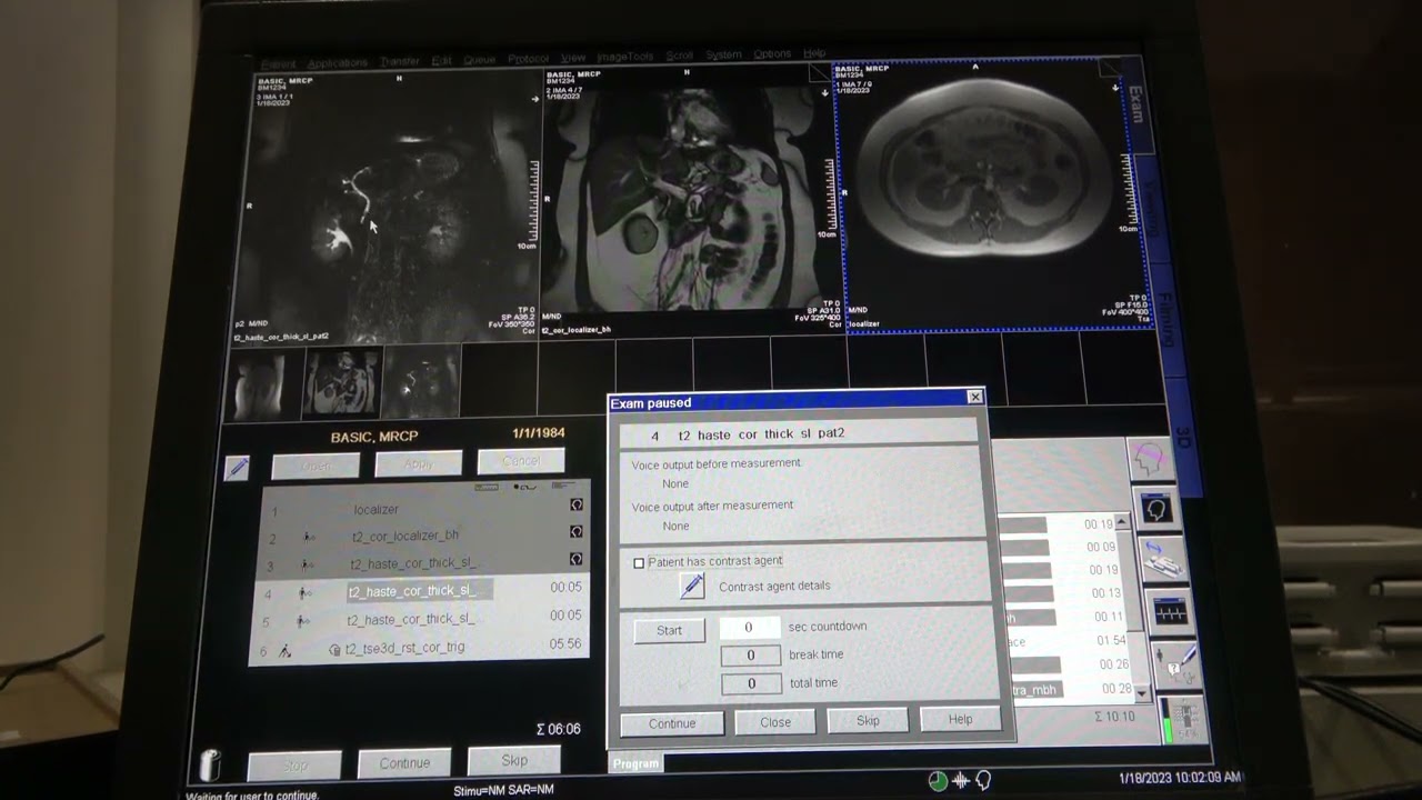 Basic MRCP MRI