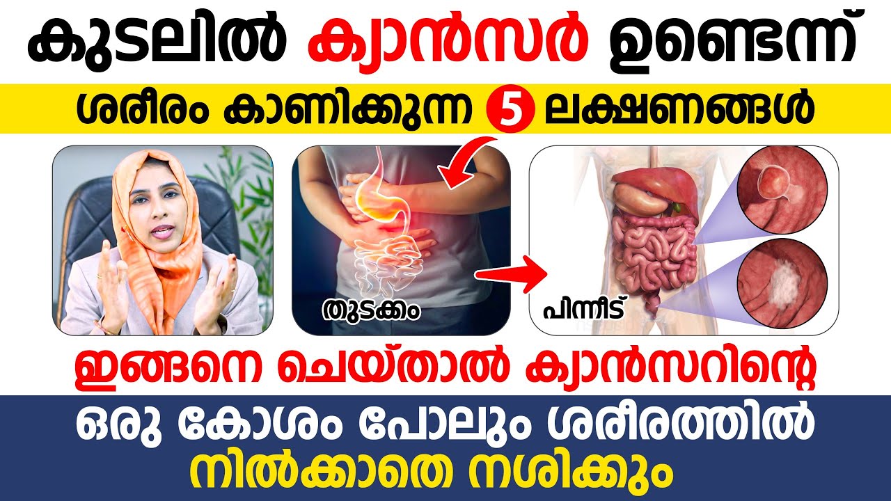 കുടലിൽ കാൻസർ ഉണ്ടെന്ന് ശരീരം കാണിച്ചു തരുന്ന 5 ലക്ഷണങ്ങൾ