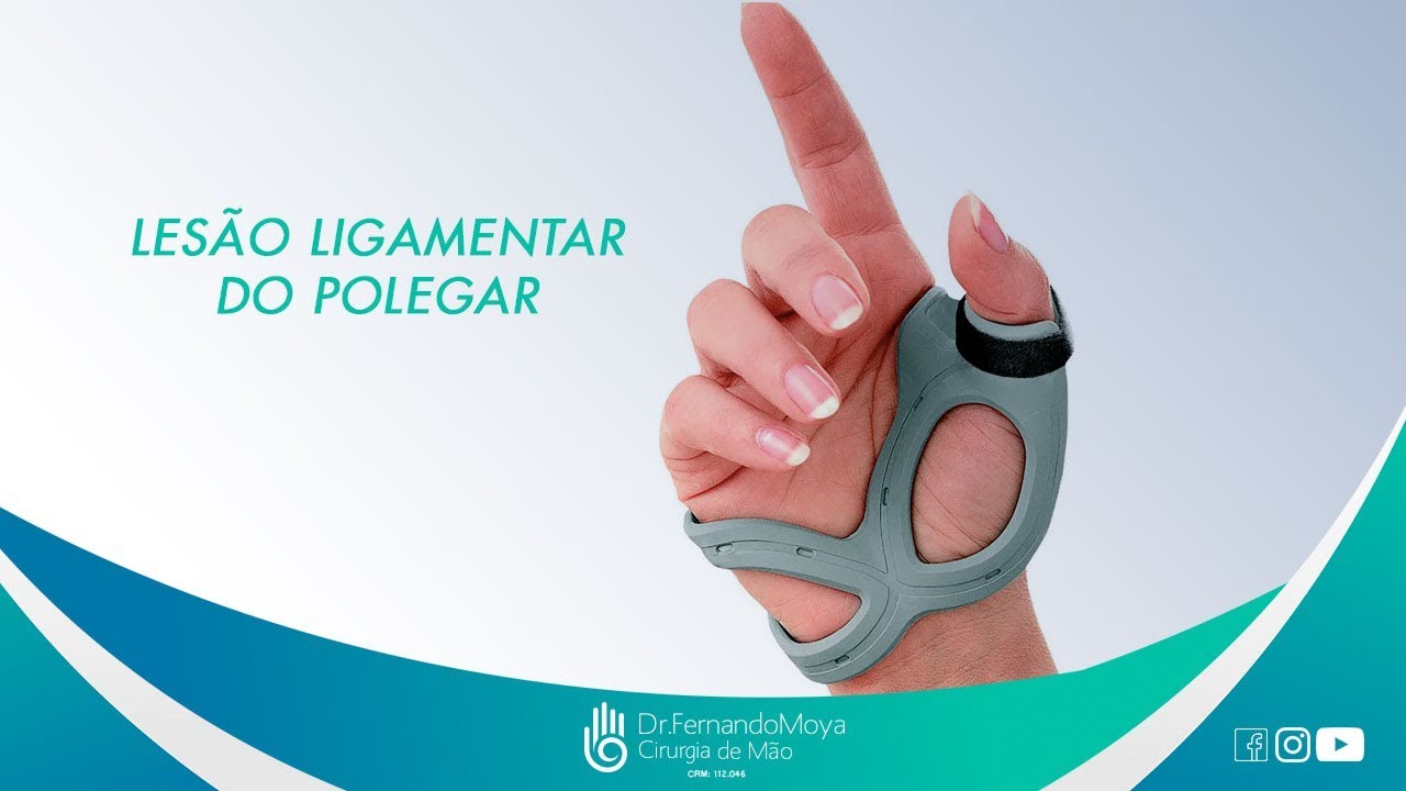 Lesão ligamentar do Polegar: o que é e tratamento | Dr. Fernando Moya CRM 112.046