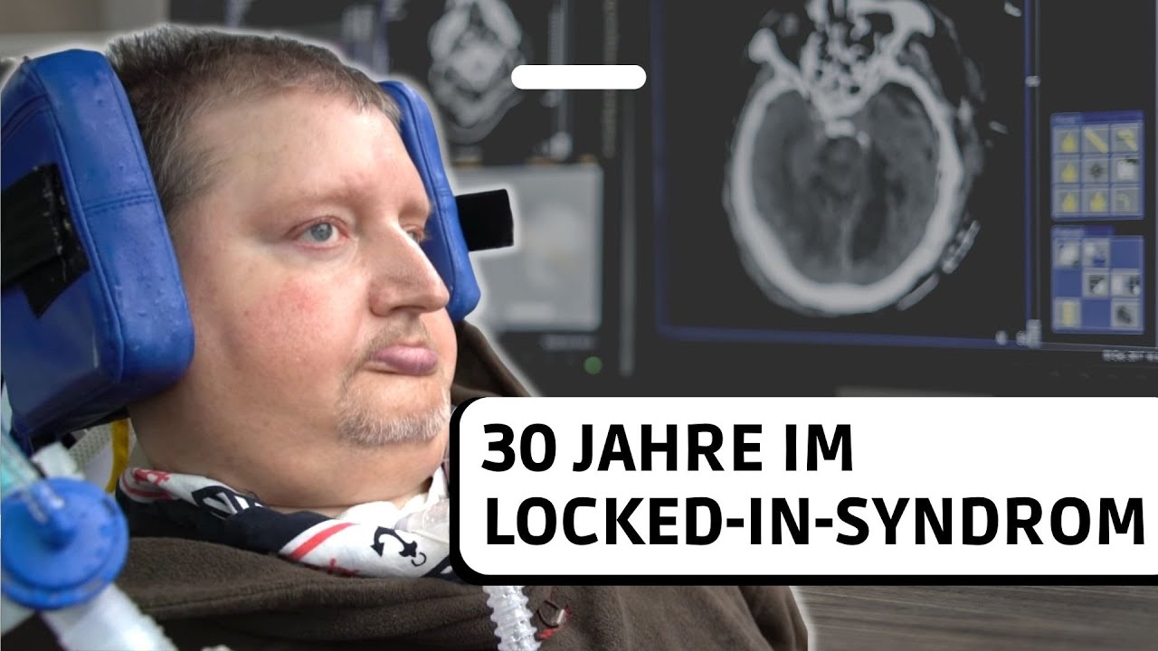 Locked-in-Syndrom nach Hirnblutung
