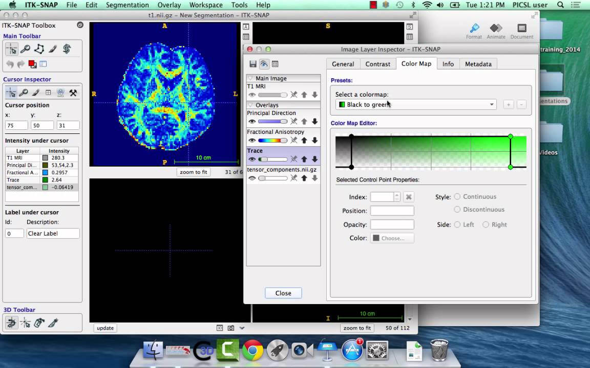 ITK-SNAP 3.2 User Training, Session 5: Working with Multiple Imaging Modalities
