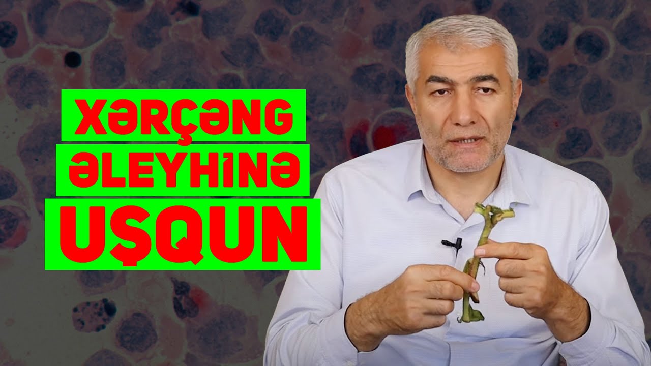 Xərçəng əleyhinə - UŞQUN | Fizuli Hüseynov