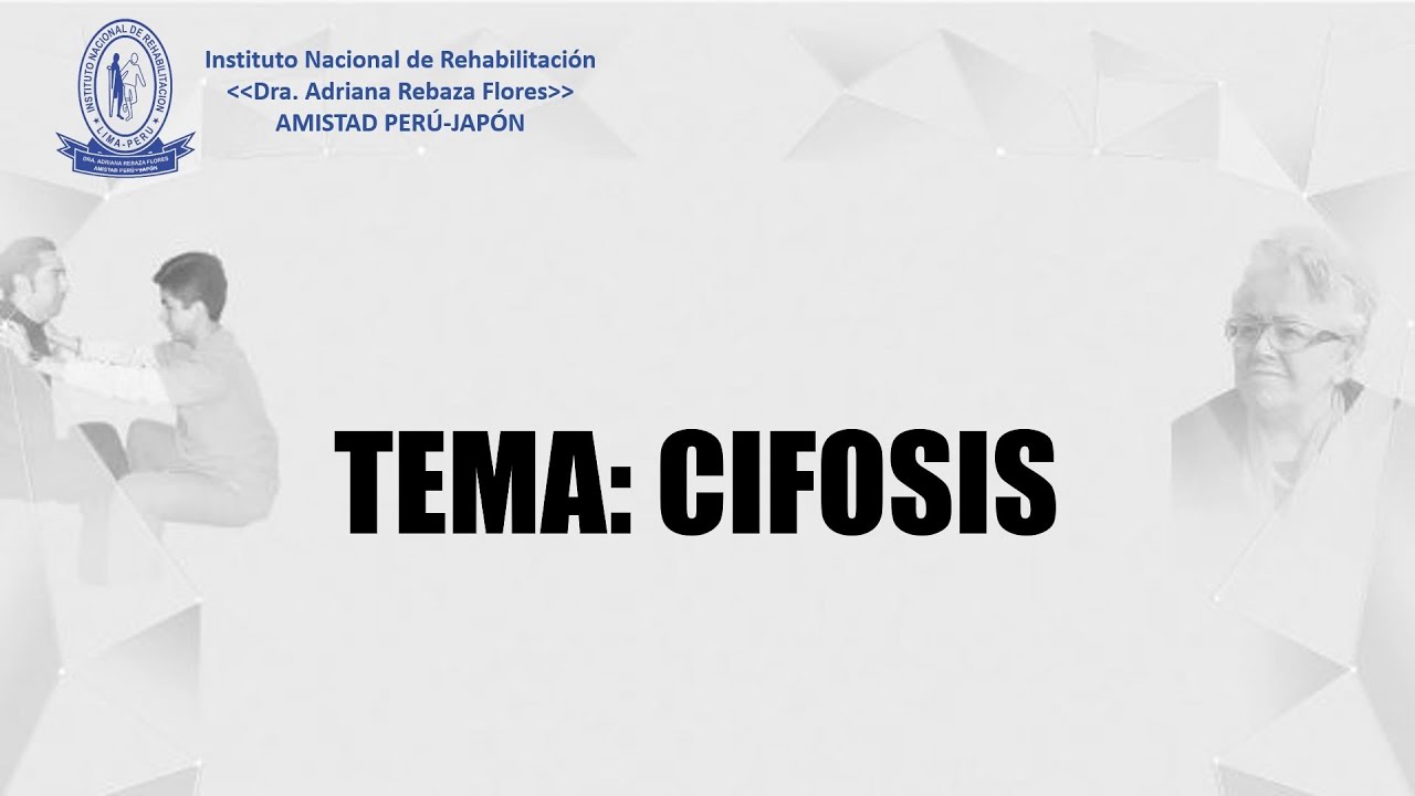 TEMA: CIFOSIS